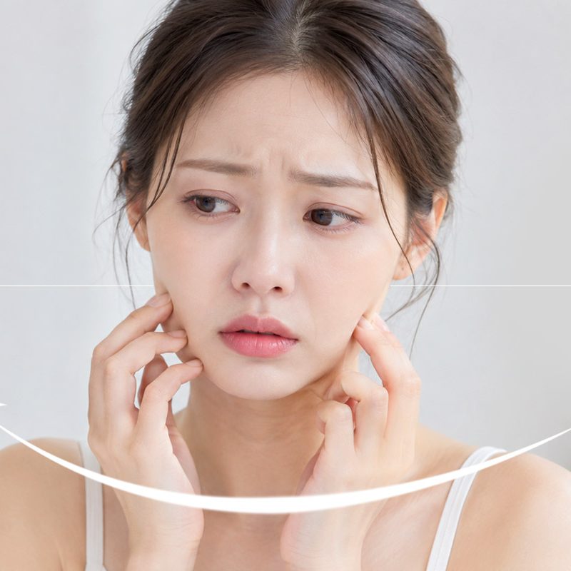 Diet Facial Sagging